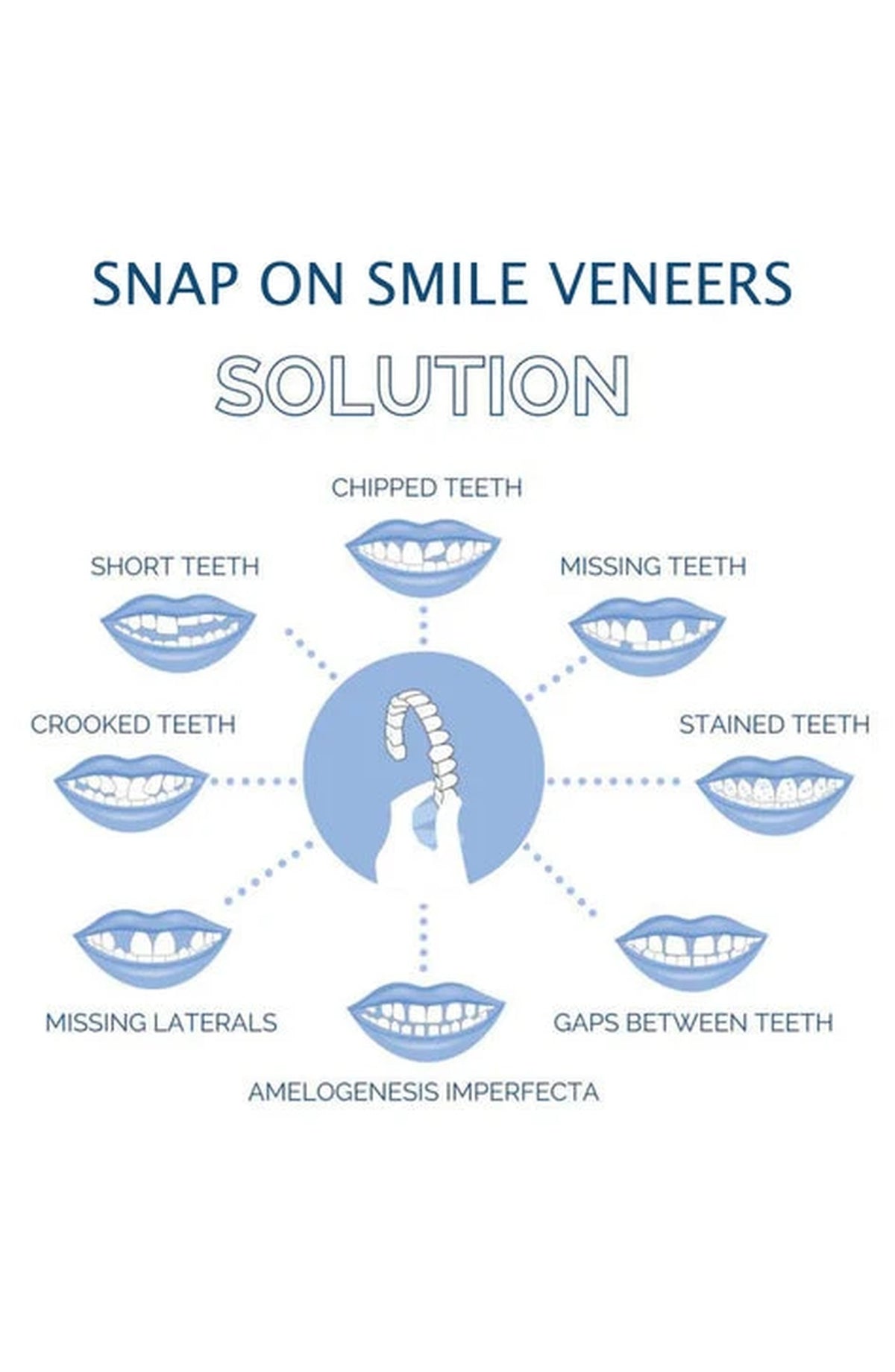 Cosmetic Teeth Cover, Upper and Lower Smile Veneer Set for Photos
