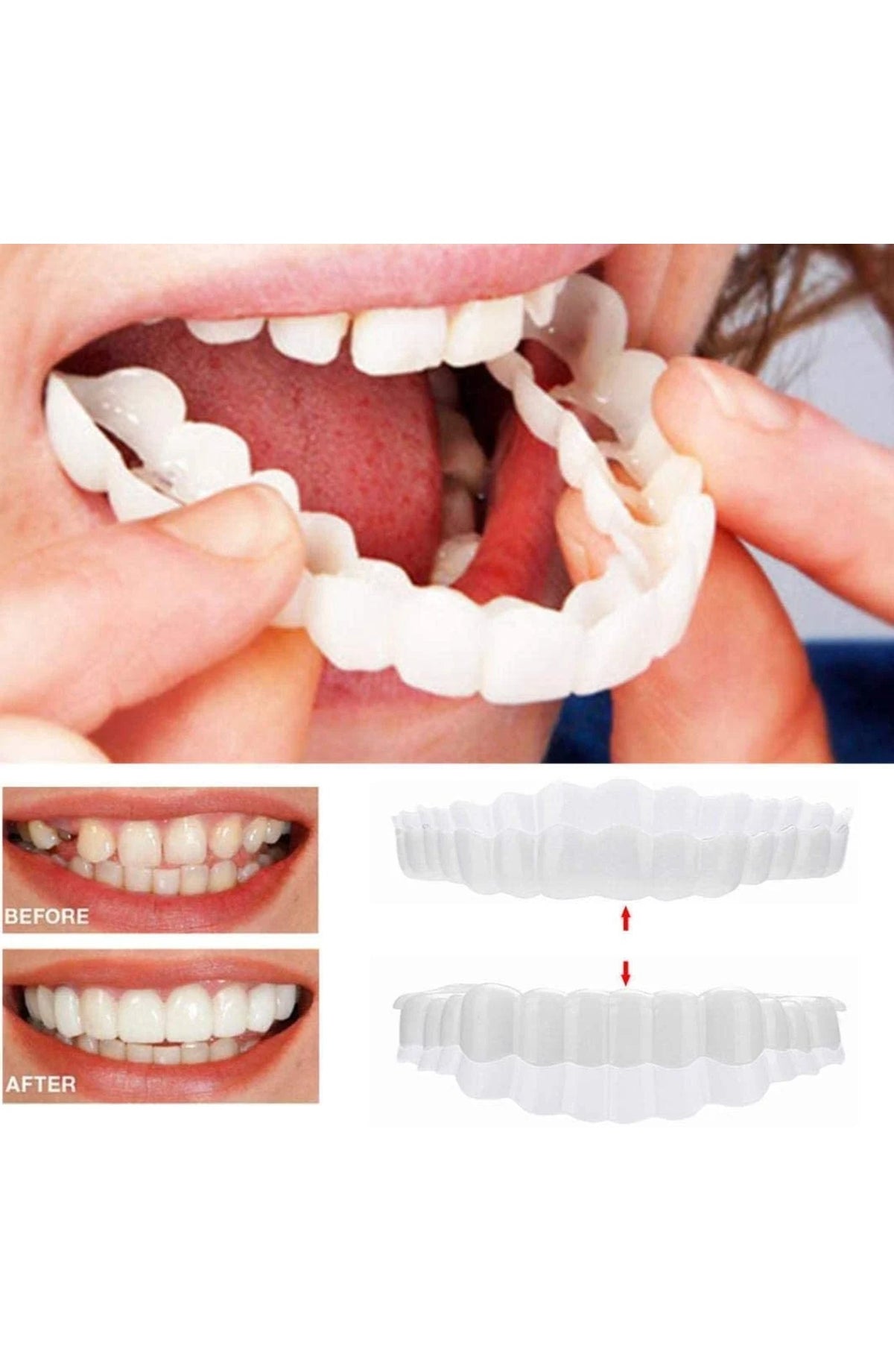 Cosmetic Teeth Cover, Upper and Lower Smile Veneer Set for Photos